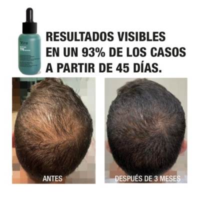 Pack anticaída Tahe Peptide T98